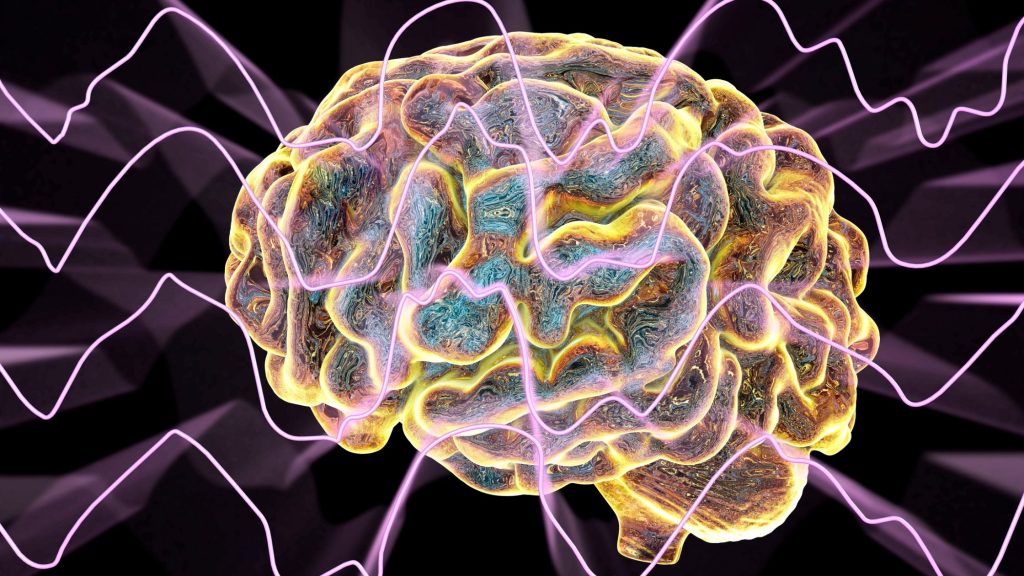 digital rendering of a human brain with electro waves